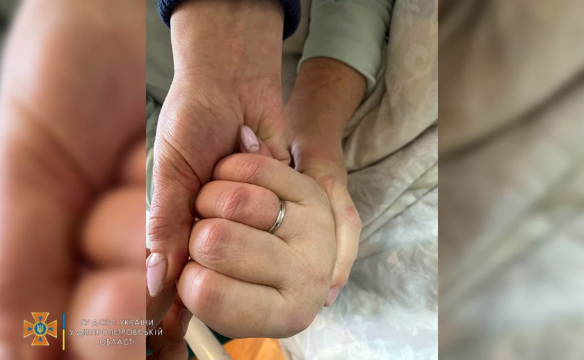 Палец уже отек: В Кривом Роге спасатели помогли снять кольцо с пальца женщины