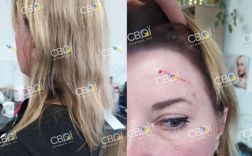 У Кривому Розі клієнтка з ножицями напала та порізала перукарку: подробиці