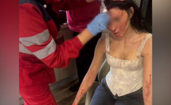 У Кривому Розі поліція розслідує напад на жінку